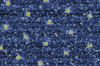 Imaging vortex matter in unconventional superconductors
